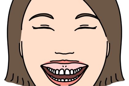 ガミースマイル